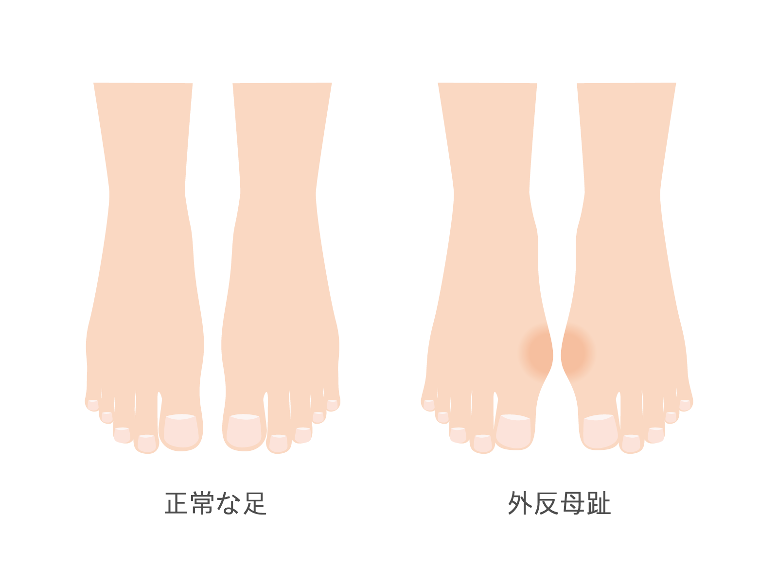 比較